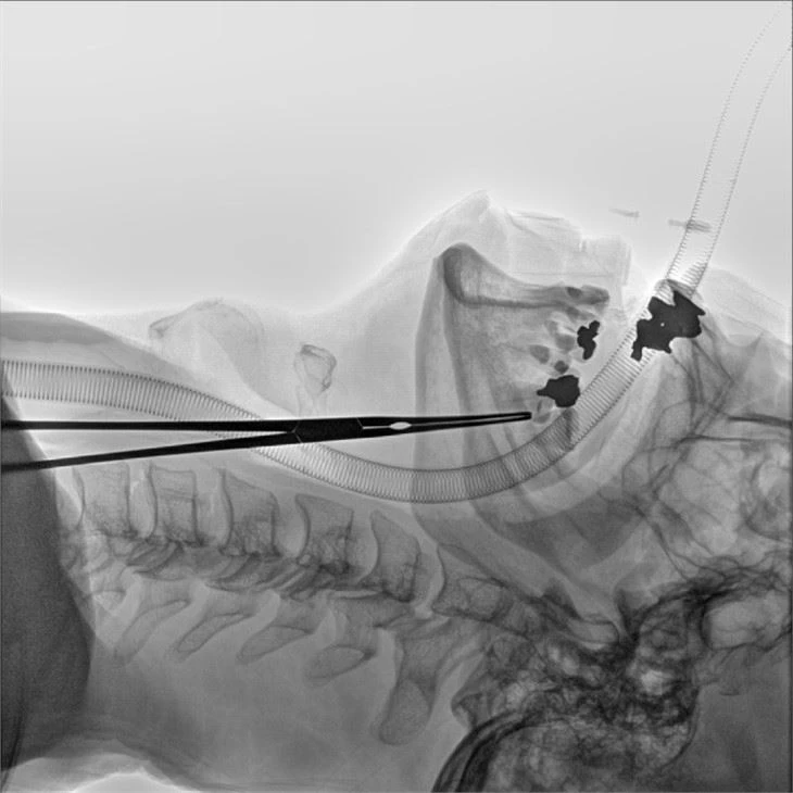 Mobile C Arm Fluoroscopy Machine